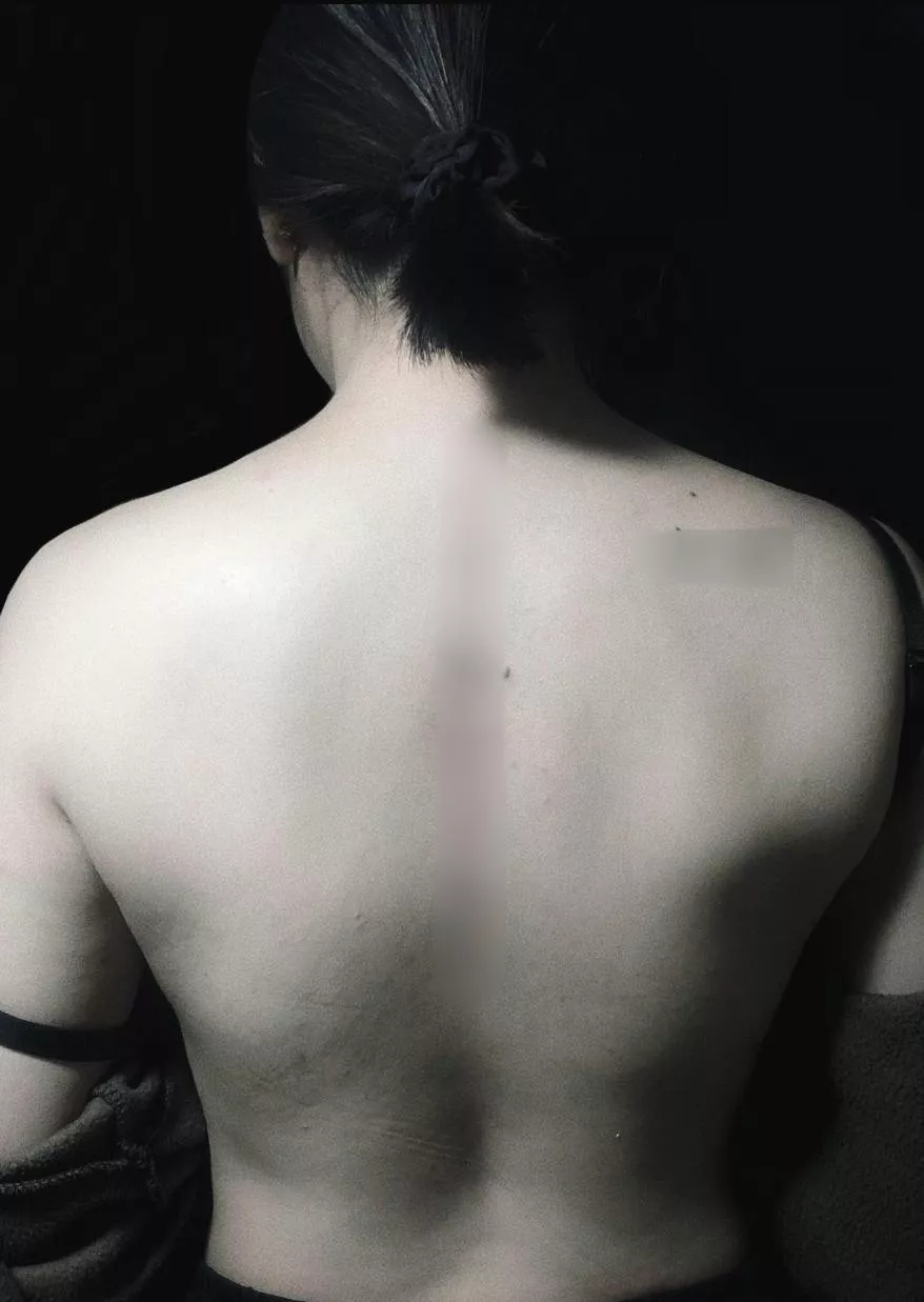 (f) mild-2- posted by cookietootie