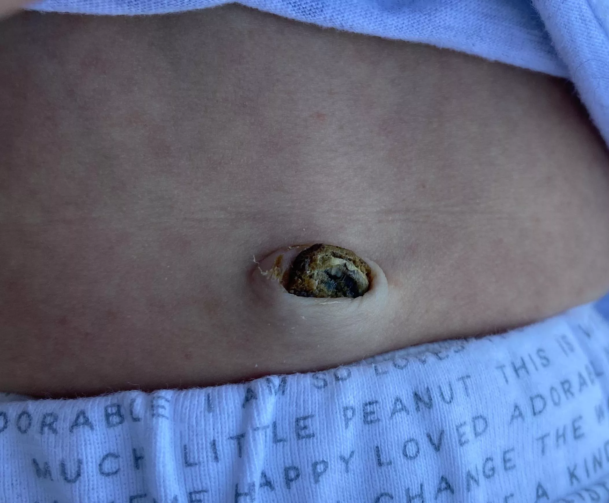 Forbidden Pop: umbilical cord posted by sweat_shorts