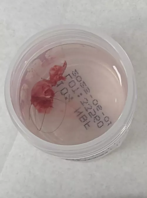 Operation Cease and De-cyst, part VI! by That_girL987