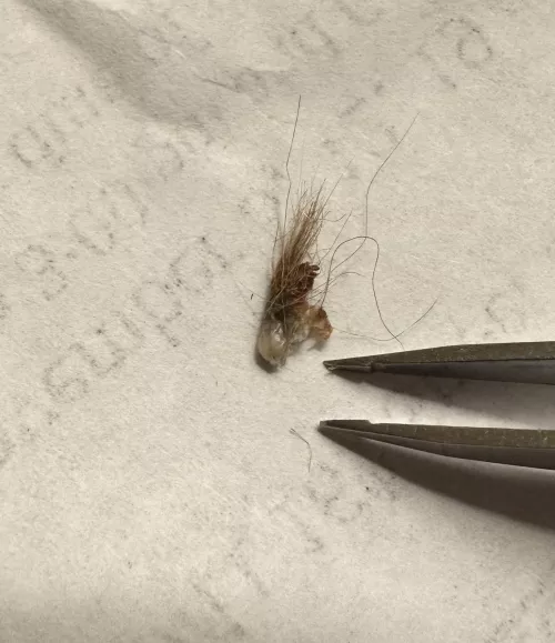 Went mining in husband’s belly button. by FridaKohlliner