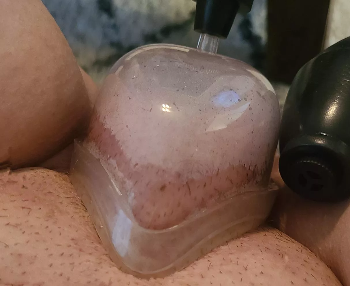 Just starting out and I'm loving it posted by PatientBumblebee6734