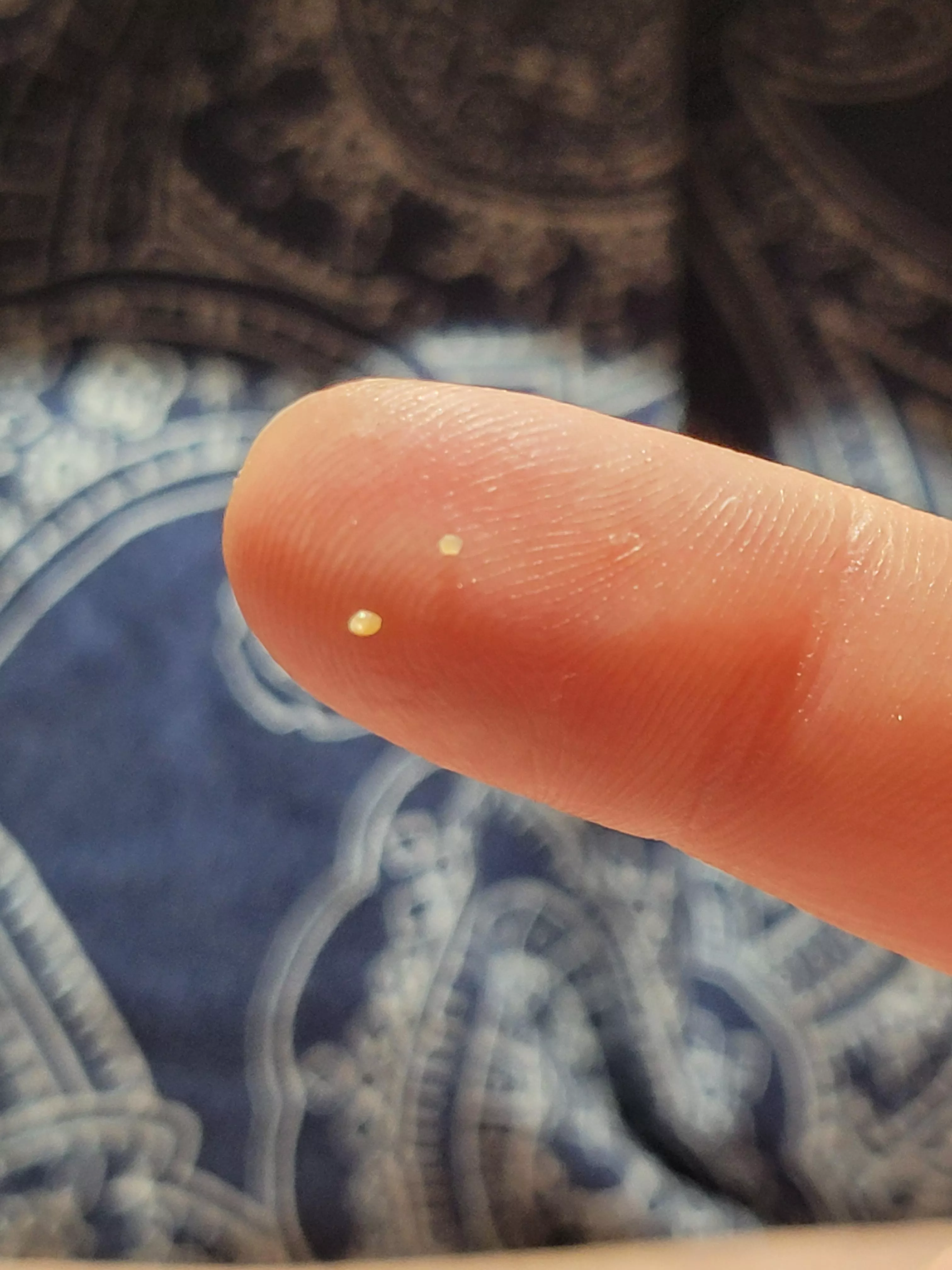 Little blackhead dudes from my ear. posted by caitemunch