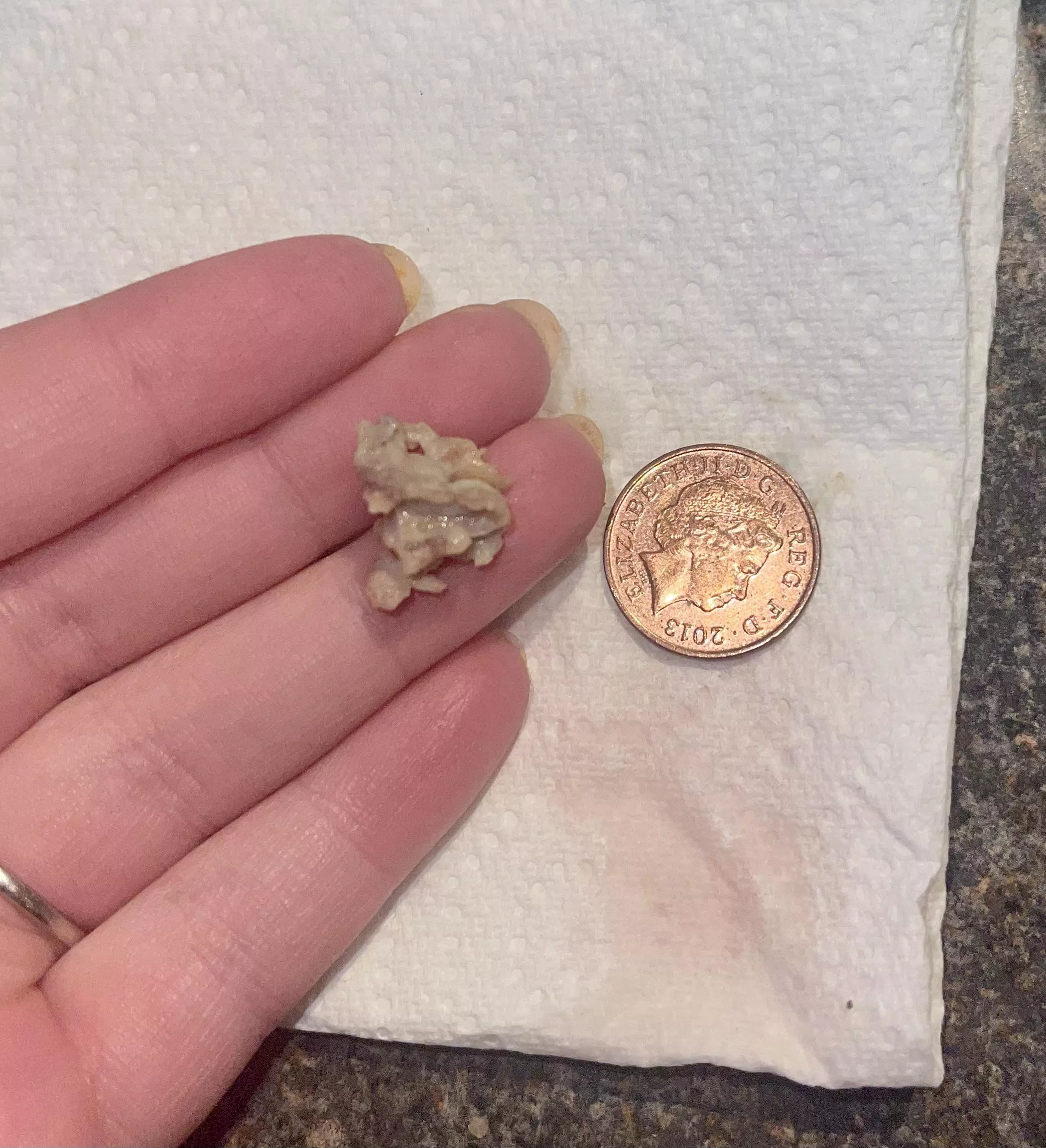 [update] on the thing I birthed from my mouth posted by sunbluff