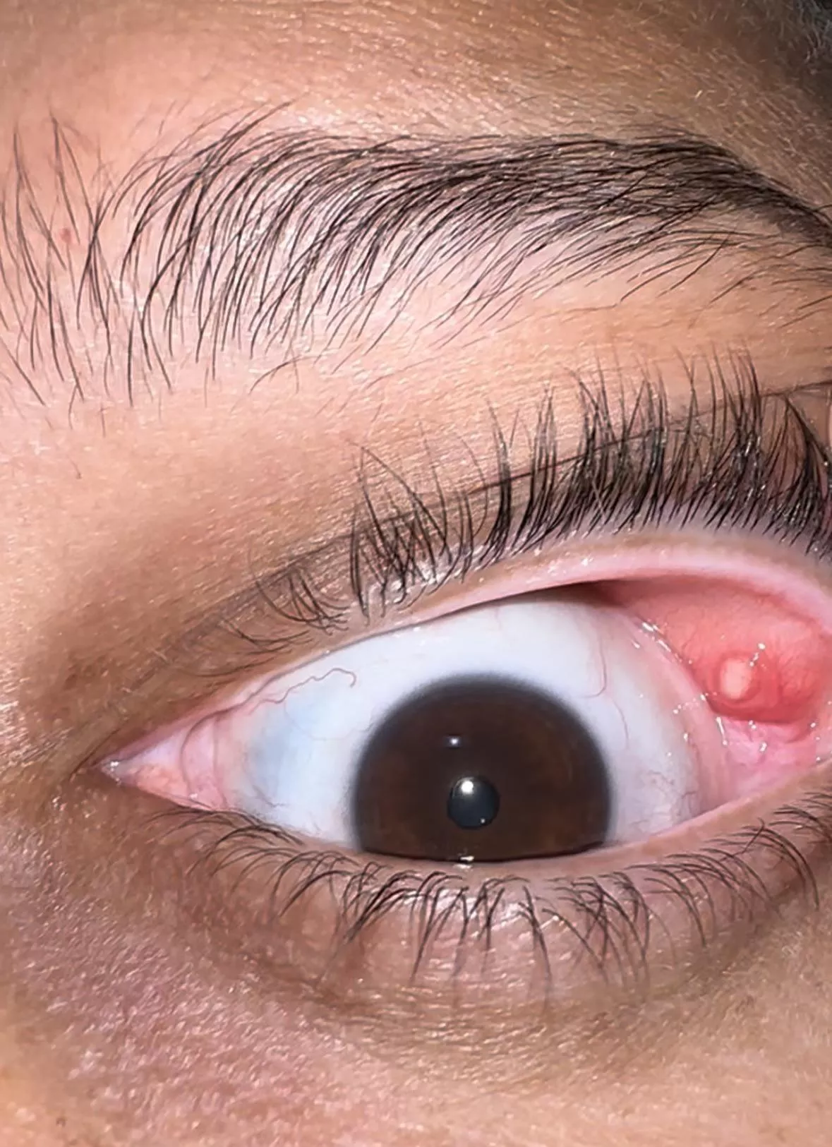 Posting again without asking questions posted by Charming_Helicopter9