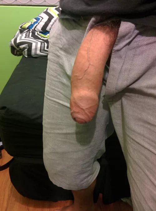 Say yes if i can send you dickpics by HungSurgeon