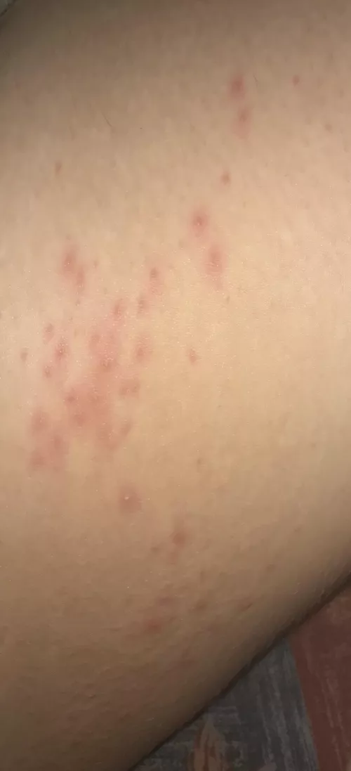 Forbidden pops from chafing by Thepolypotato