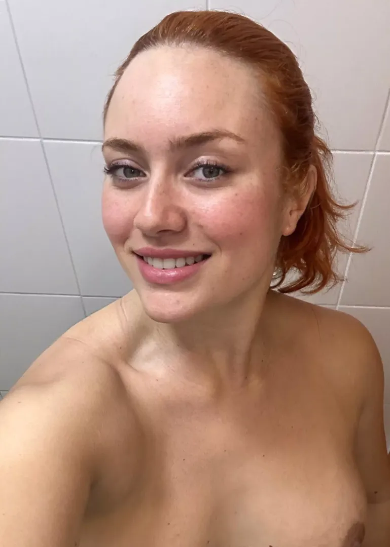 My freckles are all over my body by Puzzled_MJ