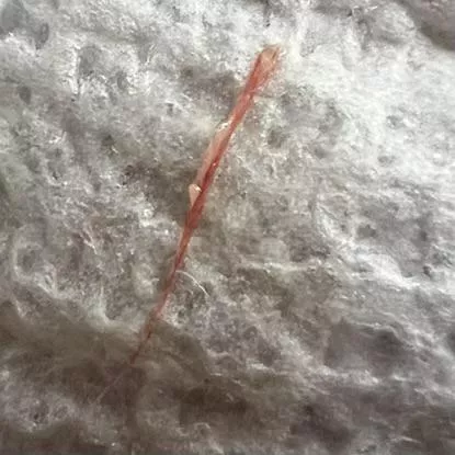 You wanted more pictures. Here is an album of the alleged worms that came out of my outer ear canal posted by roastbread