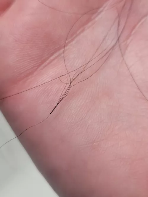 I think this is folliculitis by Helpful-Sky4443