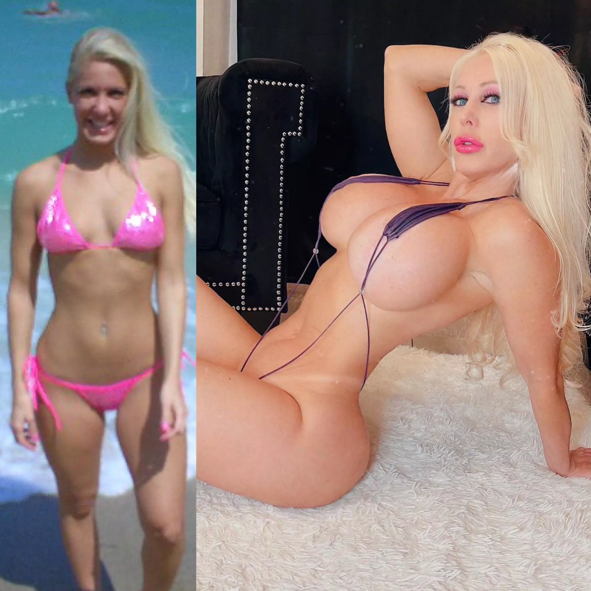 From A cup to 1500cc. I want to go bigger but i am worried about symmetry. What do you guys think? posted by Curvy-jenna