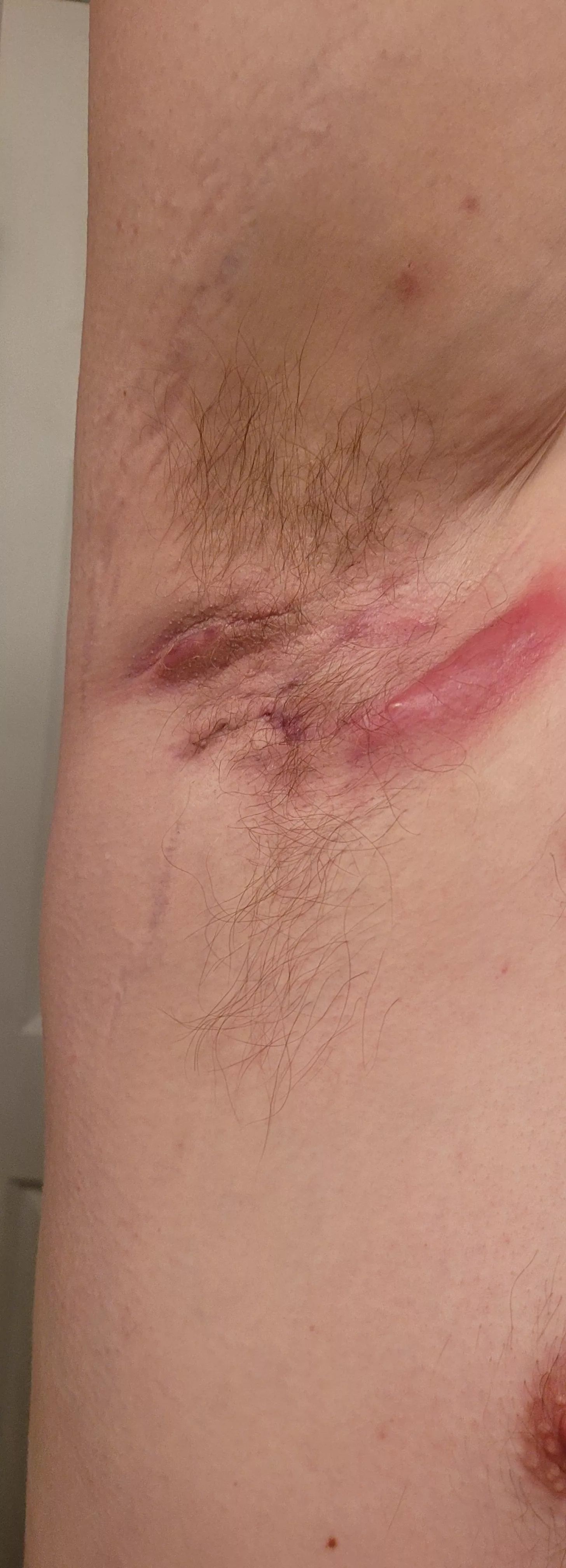 The joys of having HS /s posted by doc_dobby