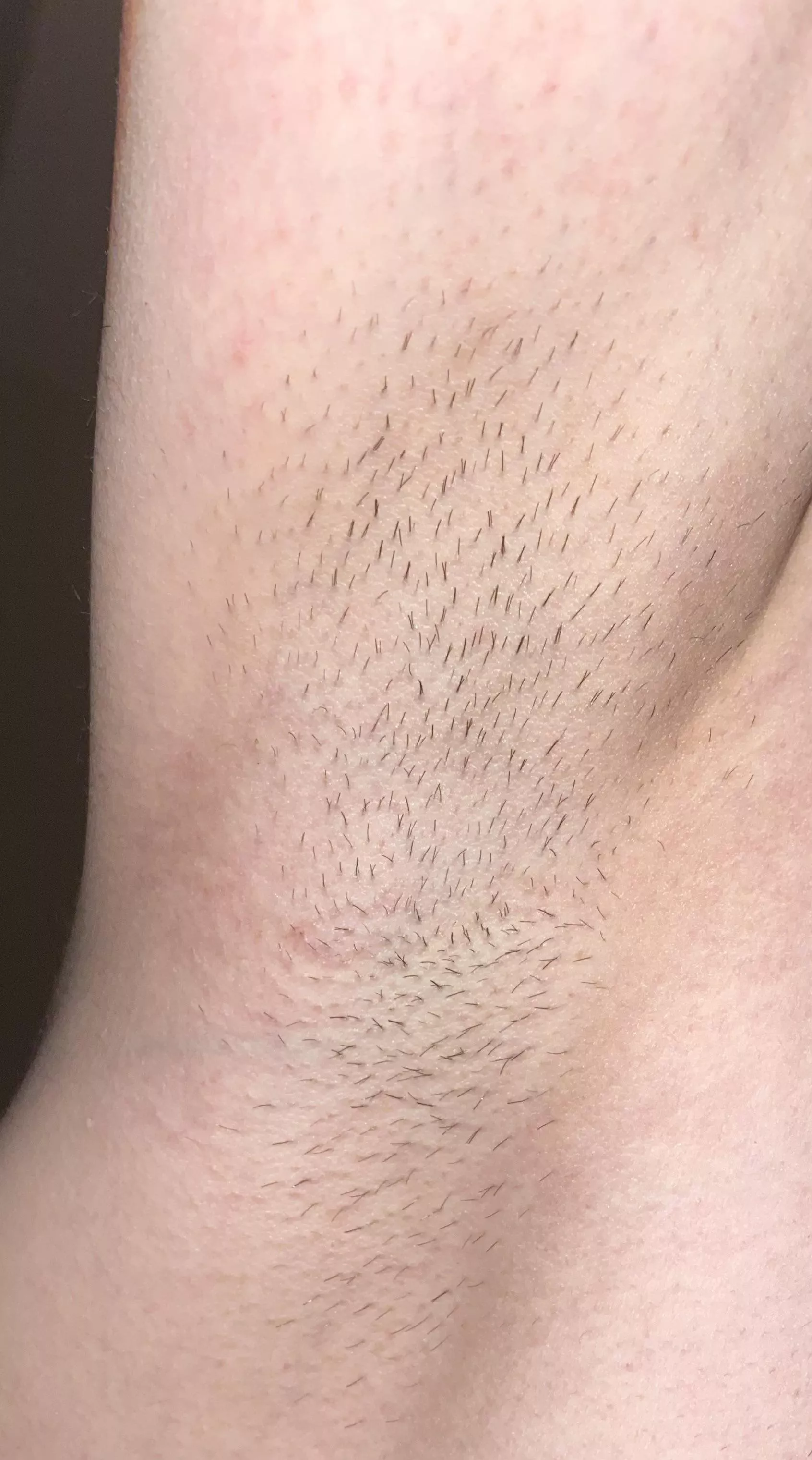 Would you lick them? posted by Littlebunnysurprise