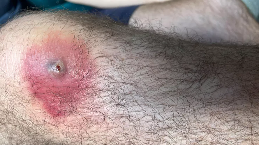 Can’t wait to pop this by pinkblazer16