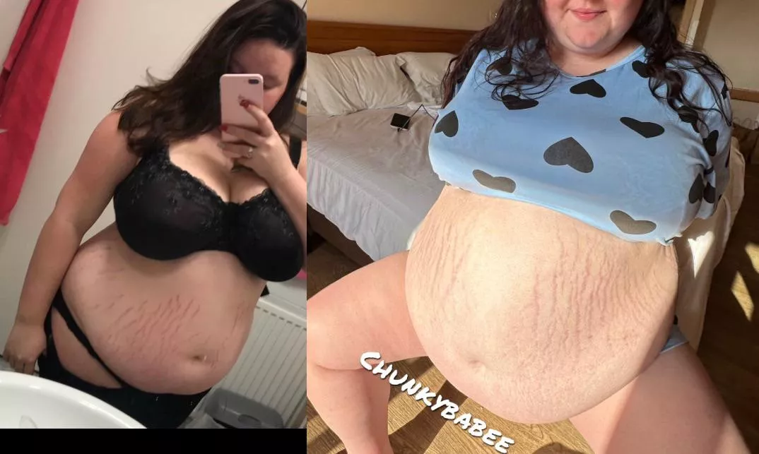 What a year of stuffing my gut did to my stretchmarks.. posted by xChunkyBabee