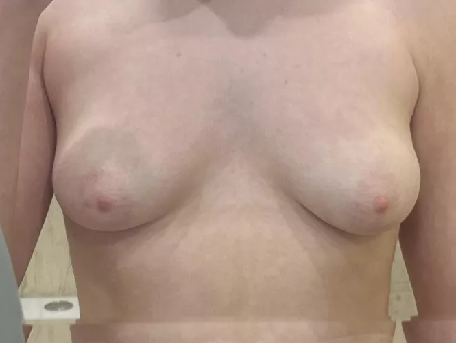 f19, 49kg, 5’1. Are my boobs ugly? by bb6608208