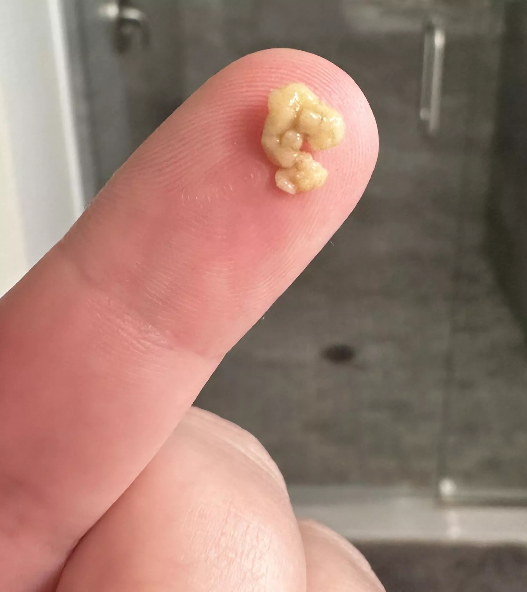 (OC) Big ole tonsil stone posted by Pickled_pepper_