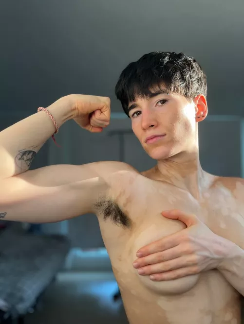 Do you like muscles? 🙈 by yourvitiligogirl