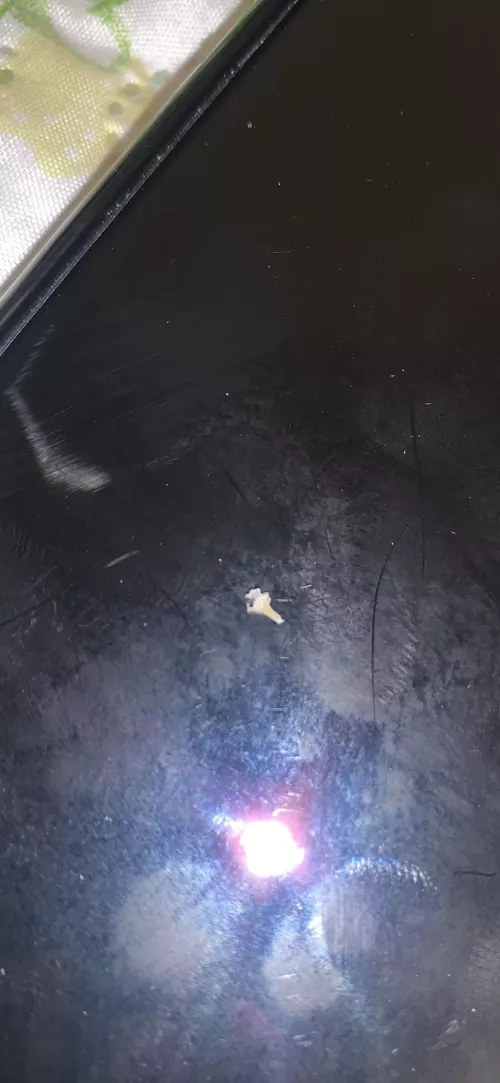 This blackhead that took two of us to pull out of my mom’s back by Jessss9