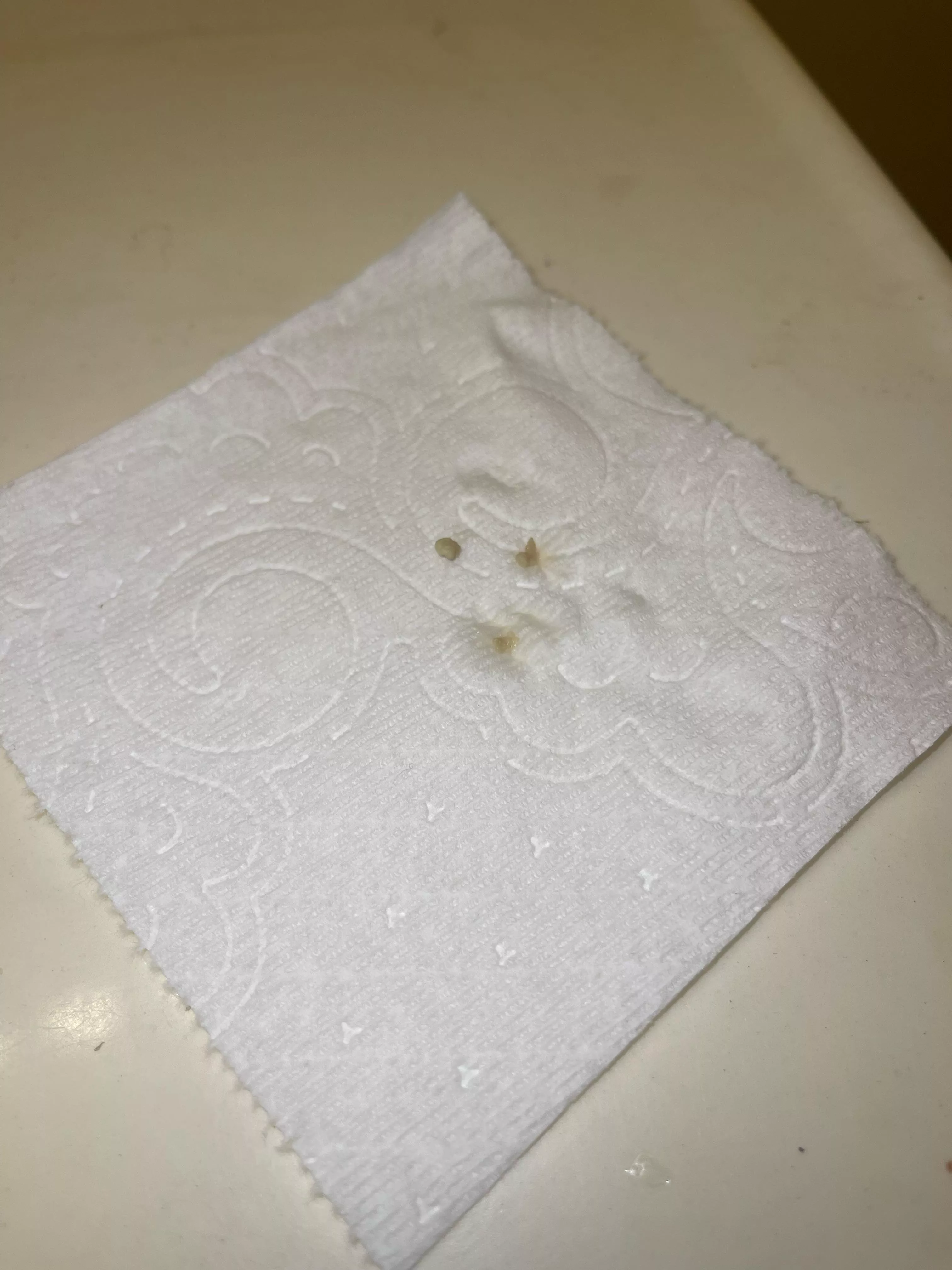 My throat felt weird all day and I had terrible breath when I woke up…wonder why posted by Total-Cantaloupe3846