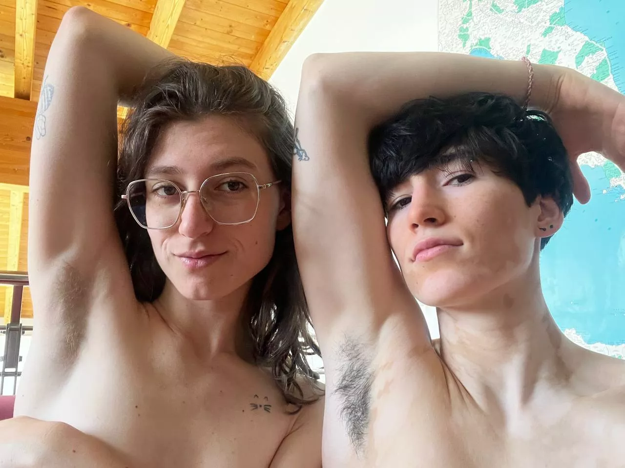 With my girl, want to join? 🔥 posted by yourvitiligogirl