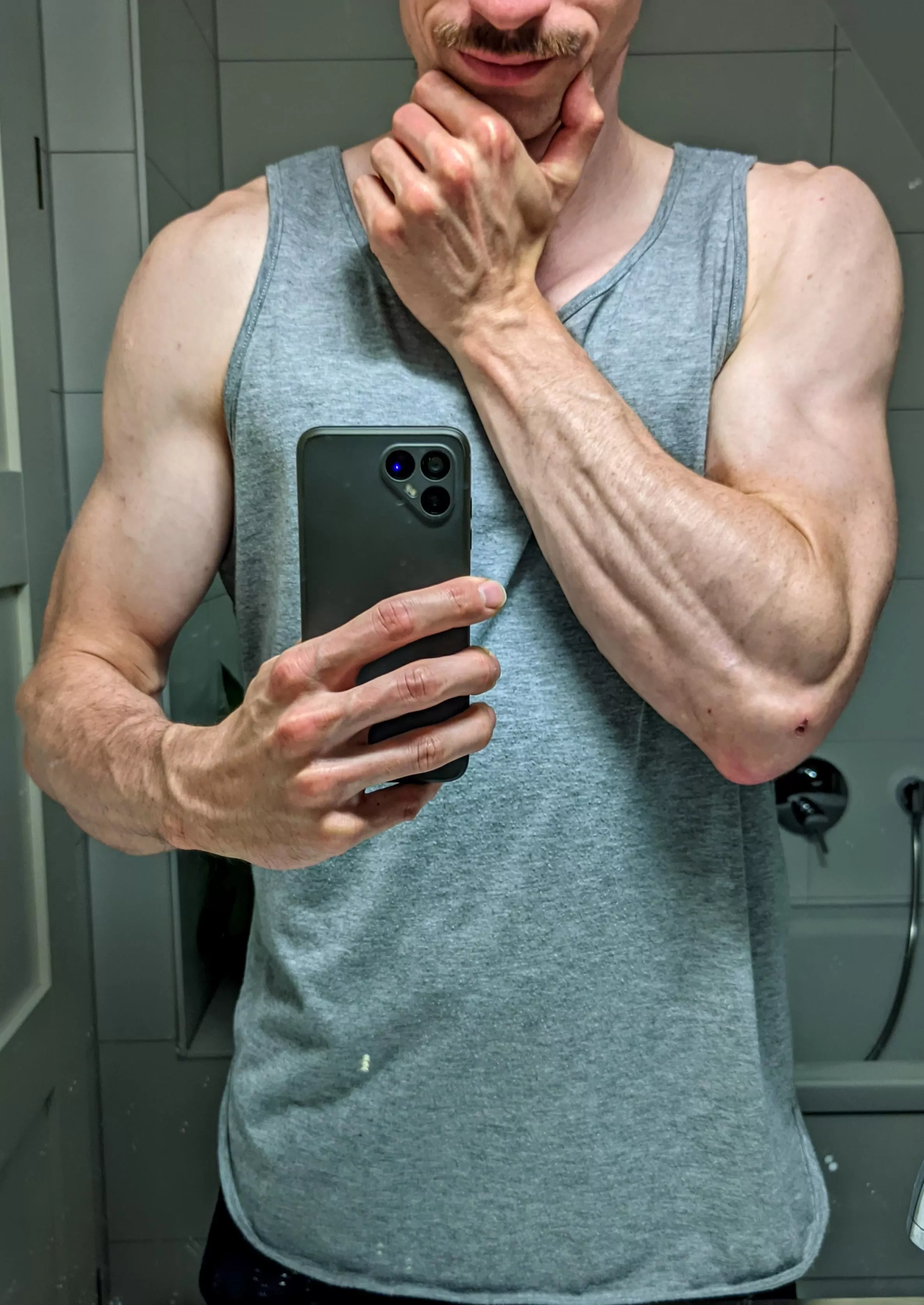 Counting tendons posted by bookehuck