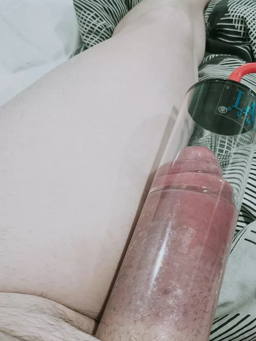 Grew another leg today 😆 by charliechoko