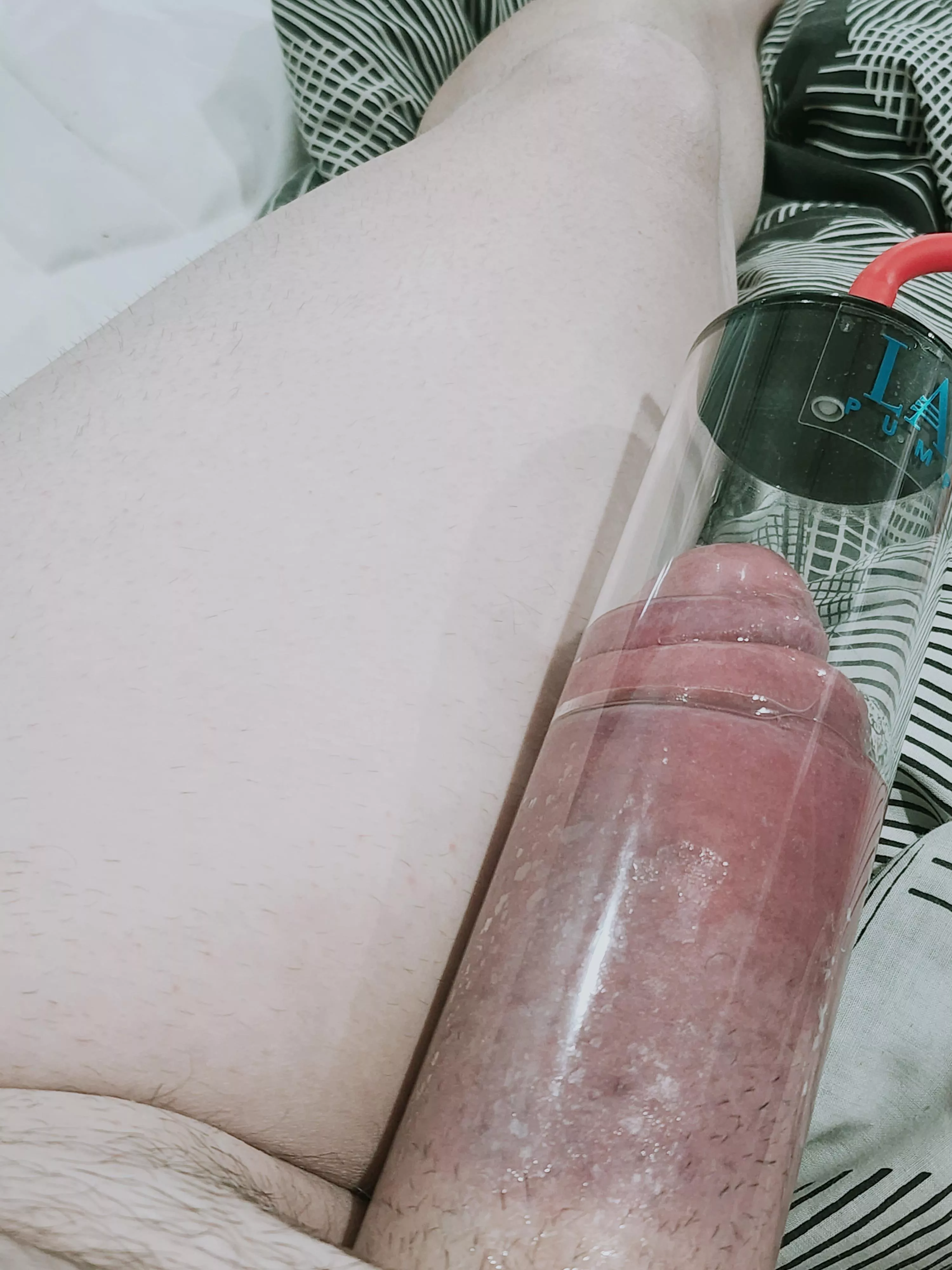 Grew another leg today 😆 posted by charliechoko