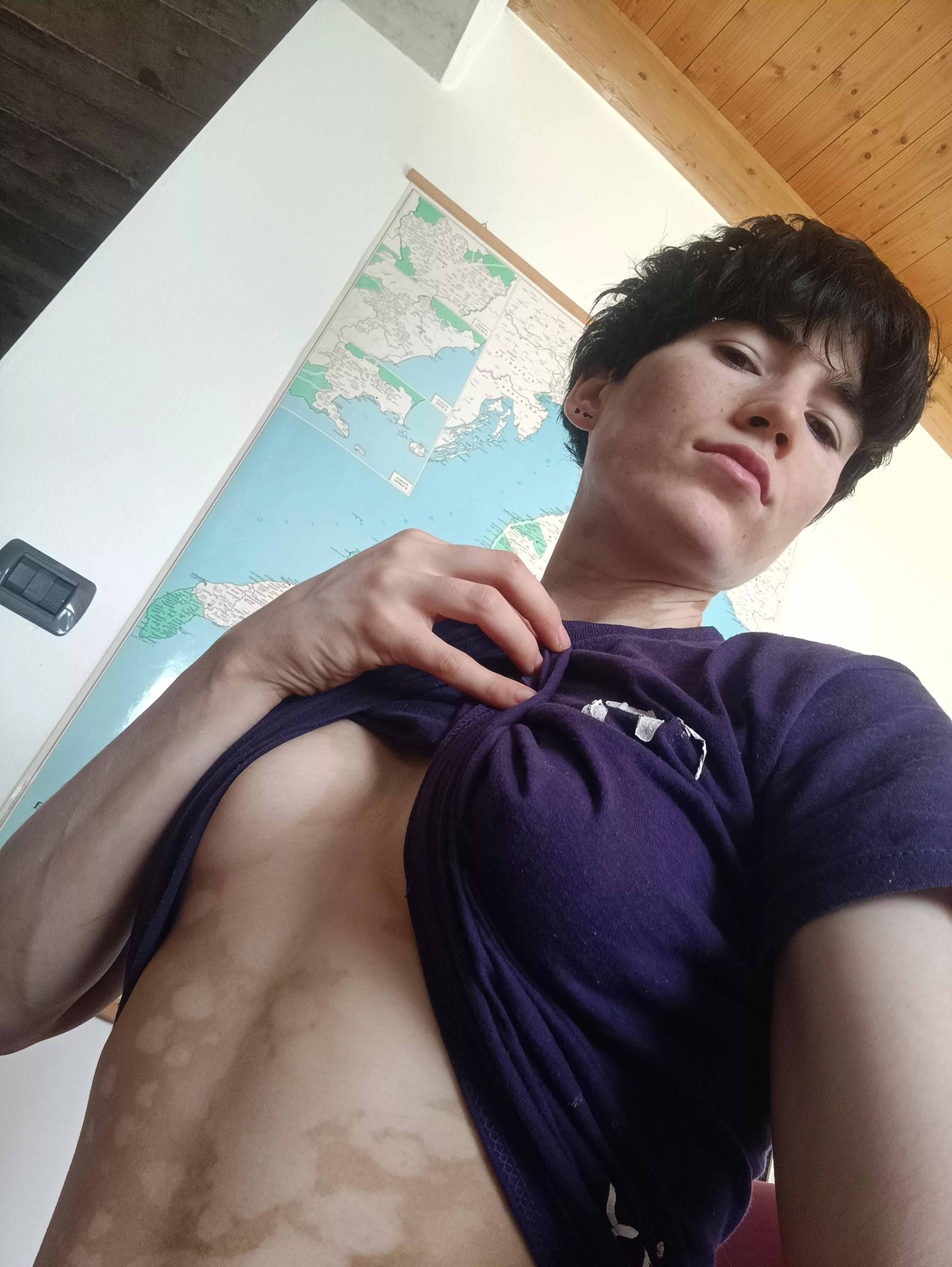 Selfie from your boi posted by yourvitiligogirl