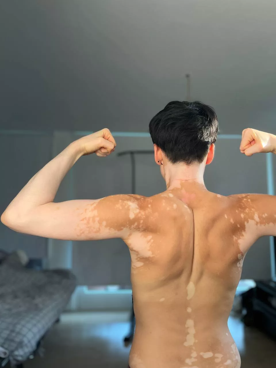 Some back 🖤 posted by yourvitiligogirl