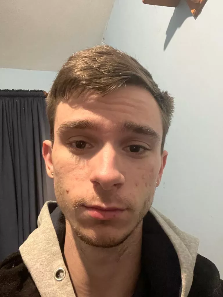 Late night selfie posted by Acrobatic-Bake2084