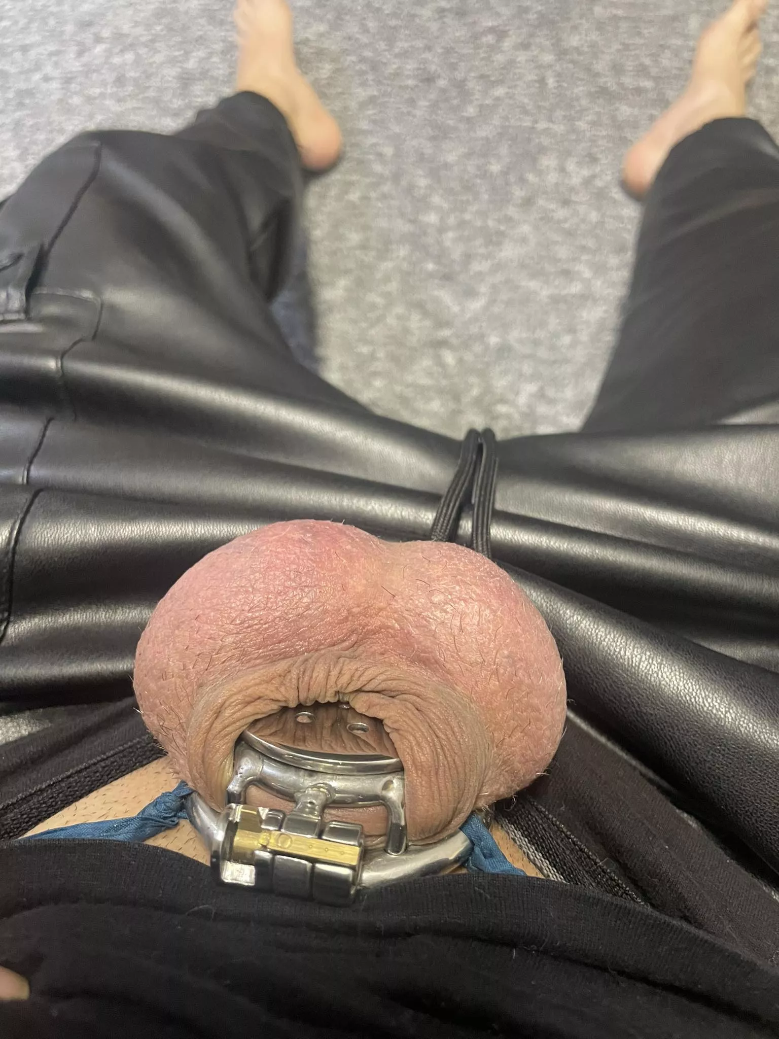 [23] Should I consider going into inverted? posted by Key-North-963