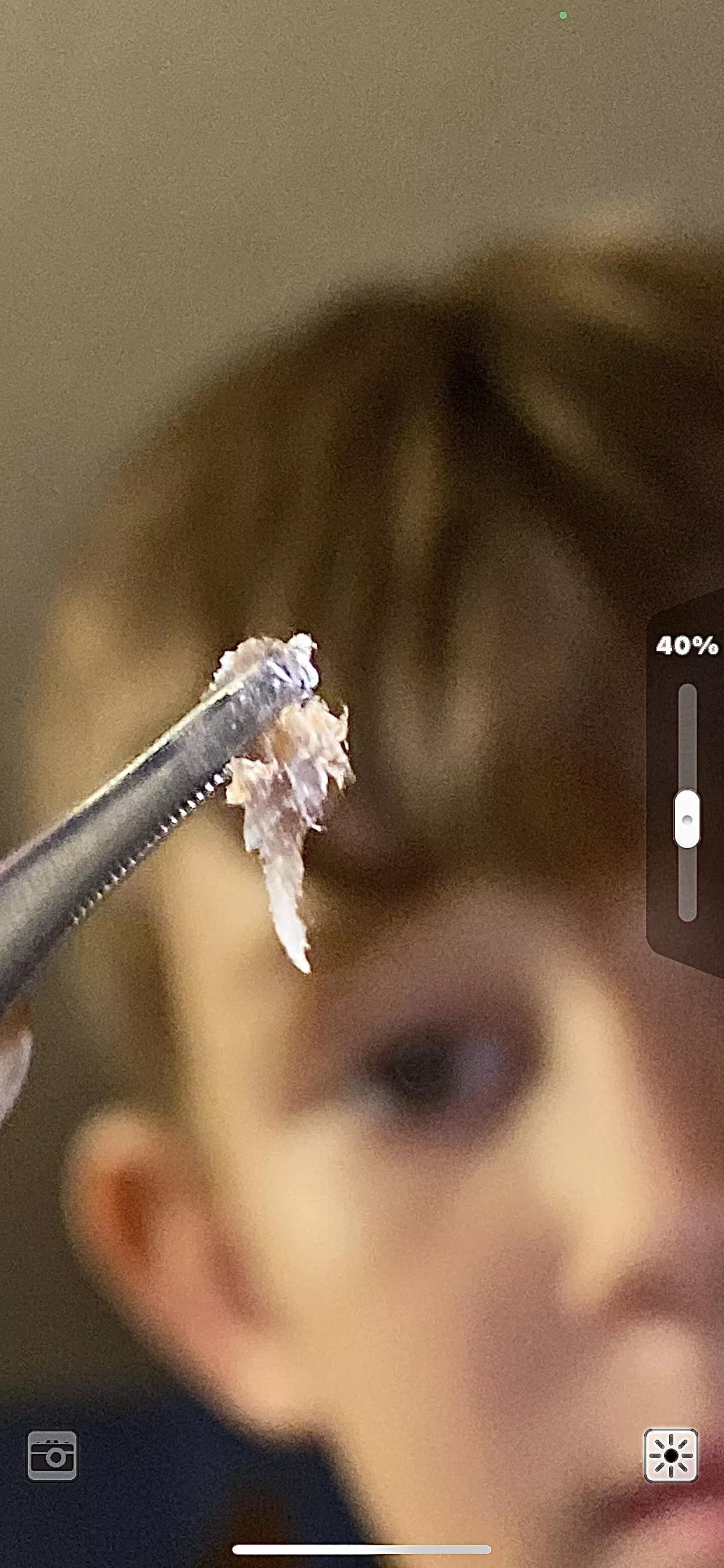 Gnarly blackhead from back posted by Big-Specialist9692