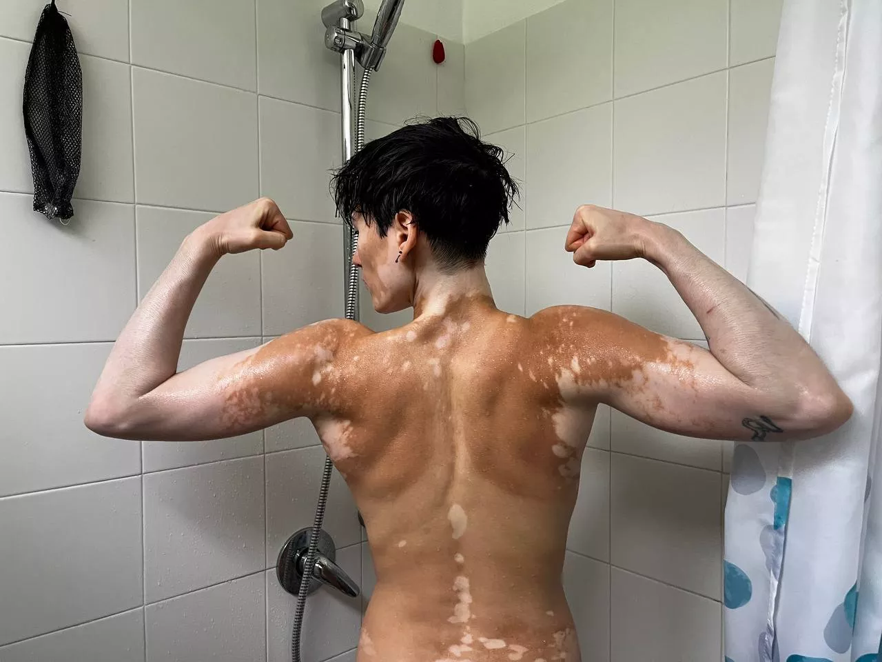 Muscles and dyike hehe posted by yourvitiligogirl