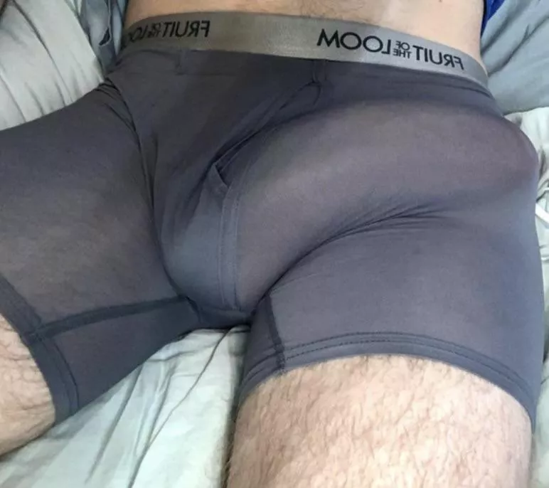 Big bulge posted by Emergency-Dealer-838