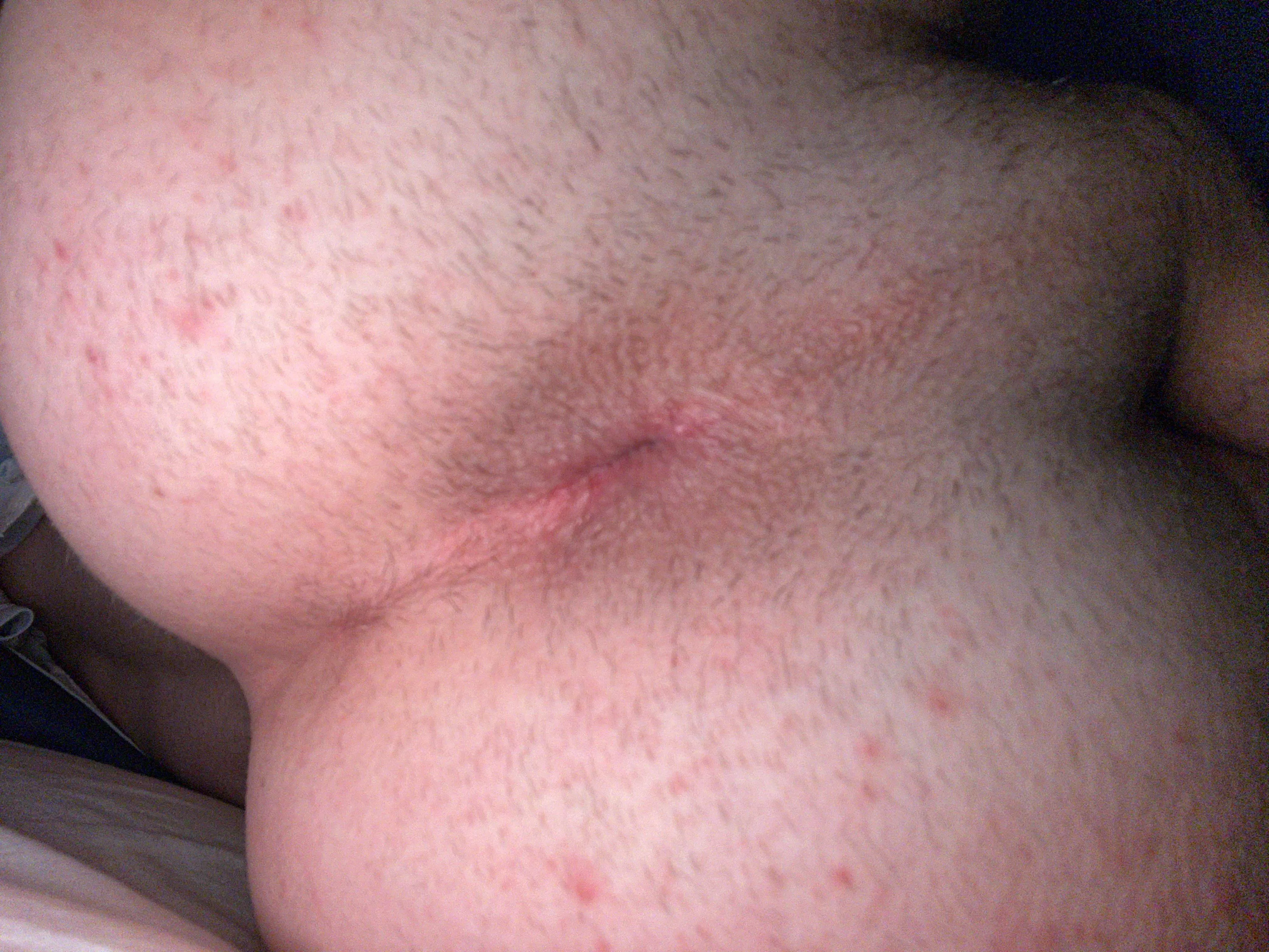 Somebody rim my virgin hole ? posted by scottish_virgin