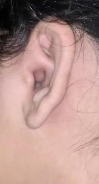 going to the doc tomorrow posted by t-rex3535