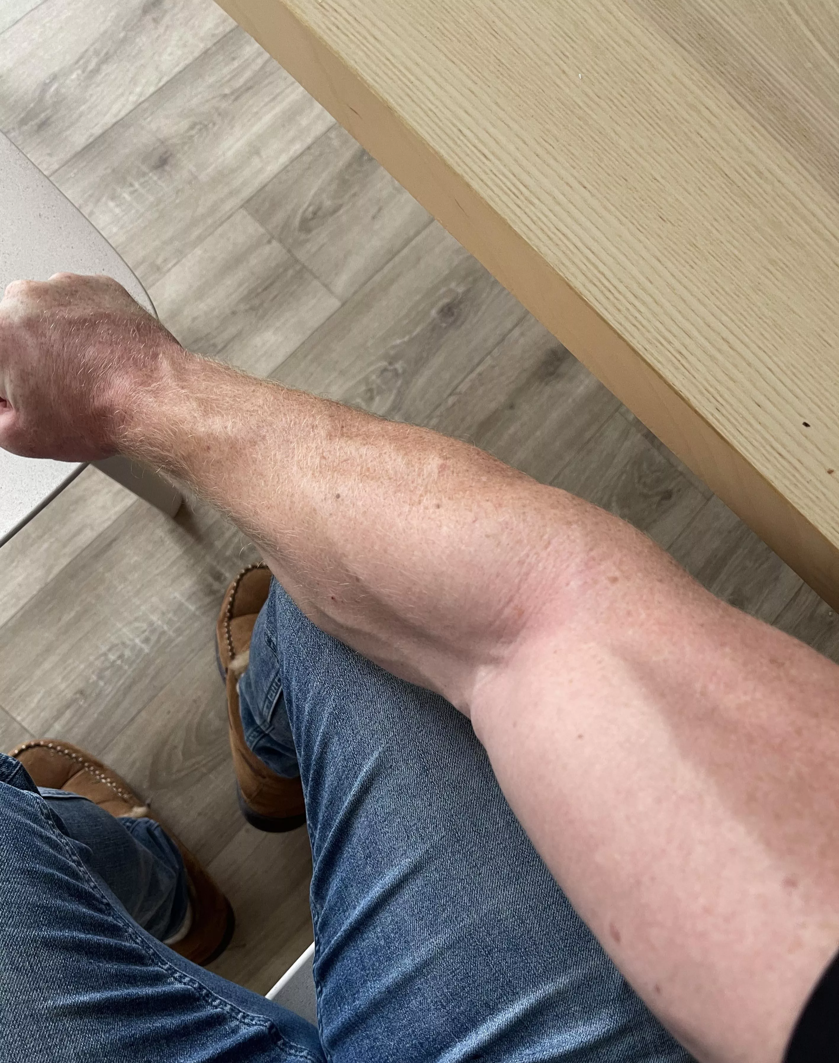 What comes to mind when seeing my hard man arms? posted by Bearded_alpha1