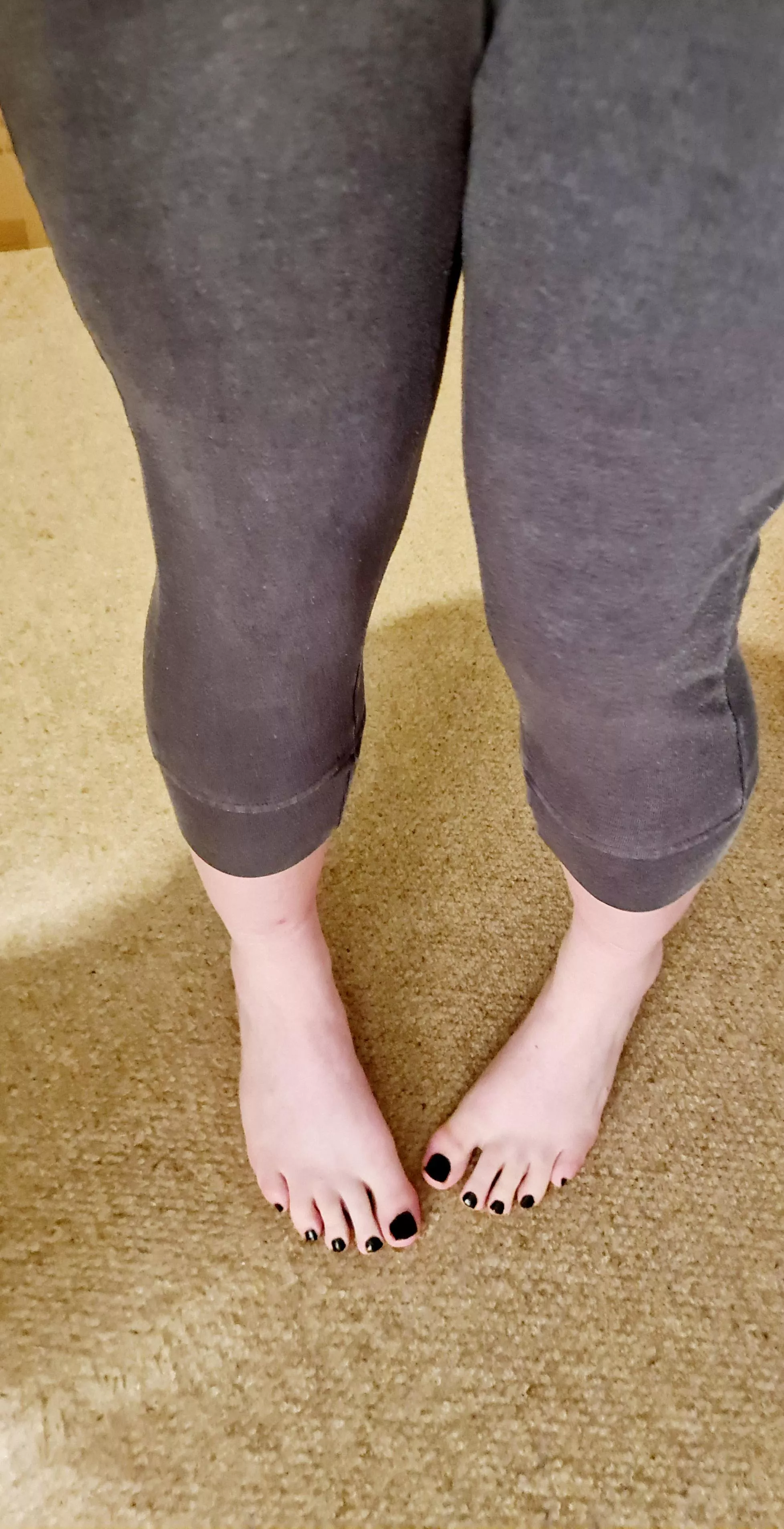 Are my black toes too dark with pale skin? posted by diademmedaid
