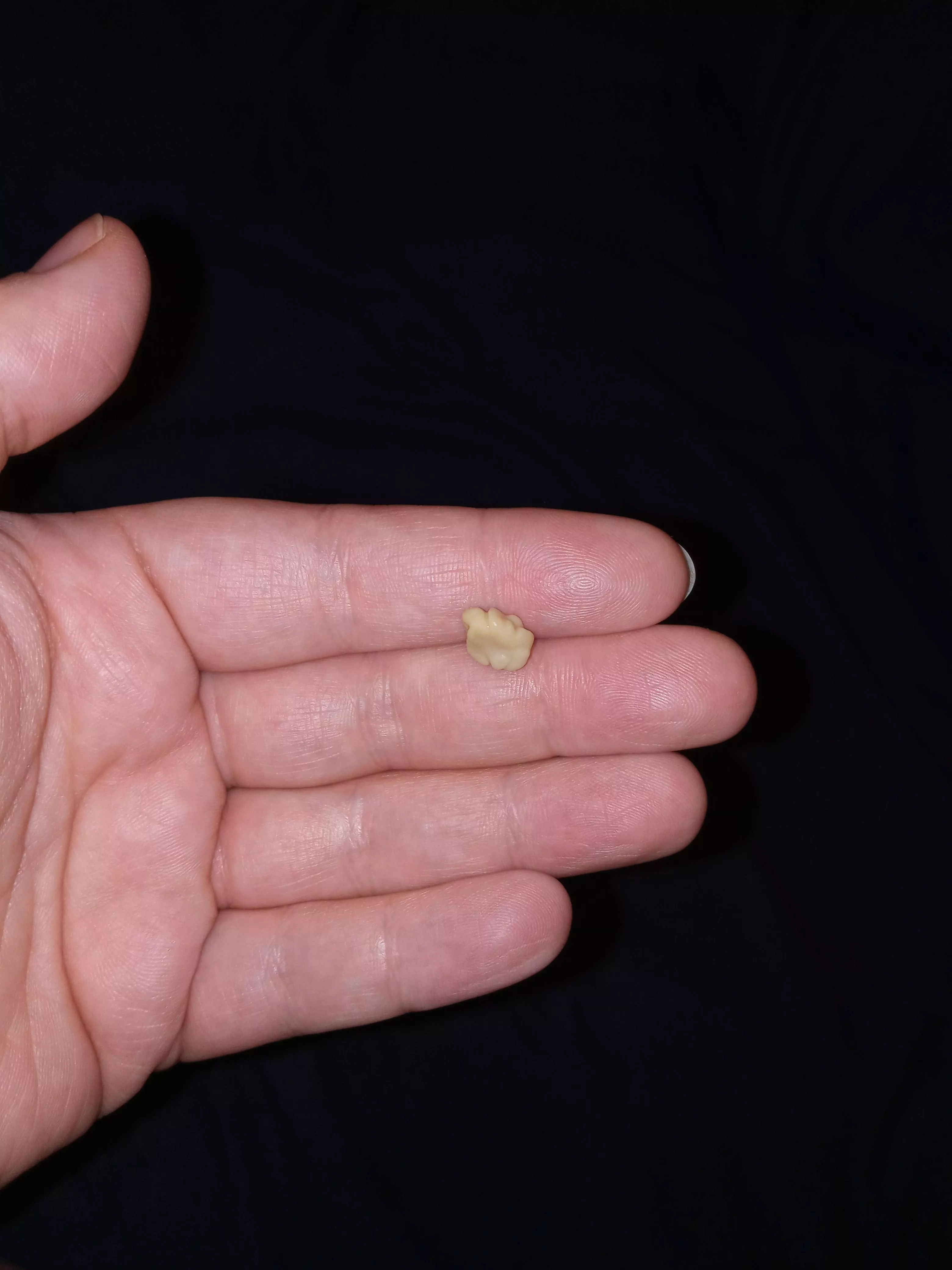 Coughed this up at 5am posted by rockbellkid