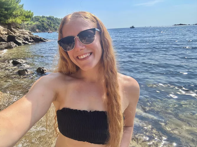 would you kiss my freckles one by one? by Kris_Daley