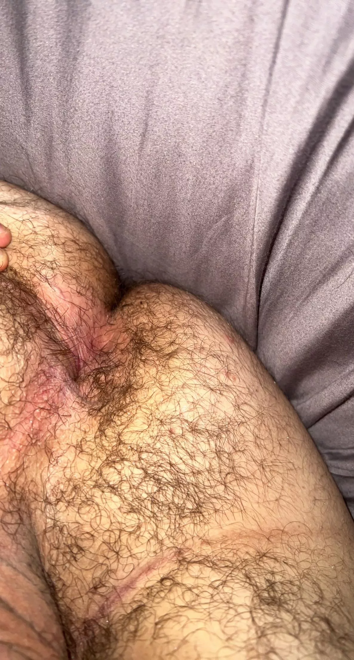 (22), use me posted by Technical_Paper_3316