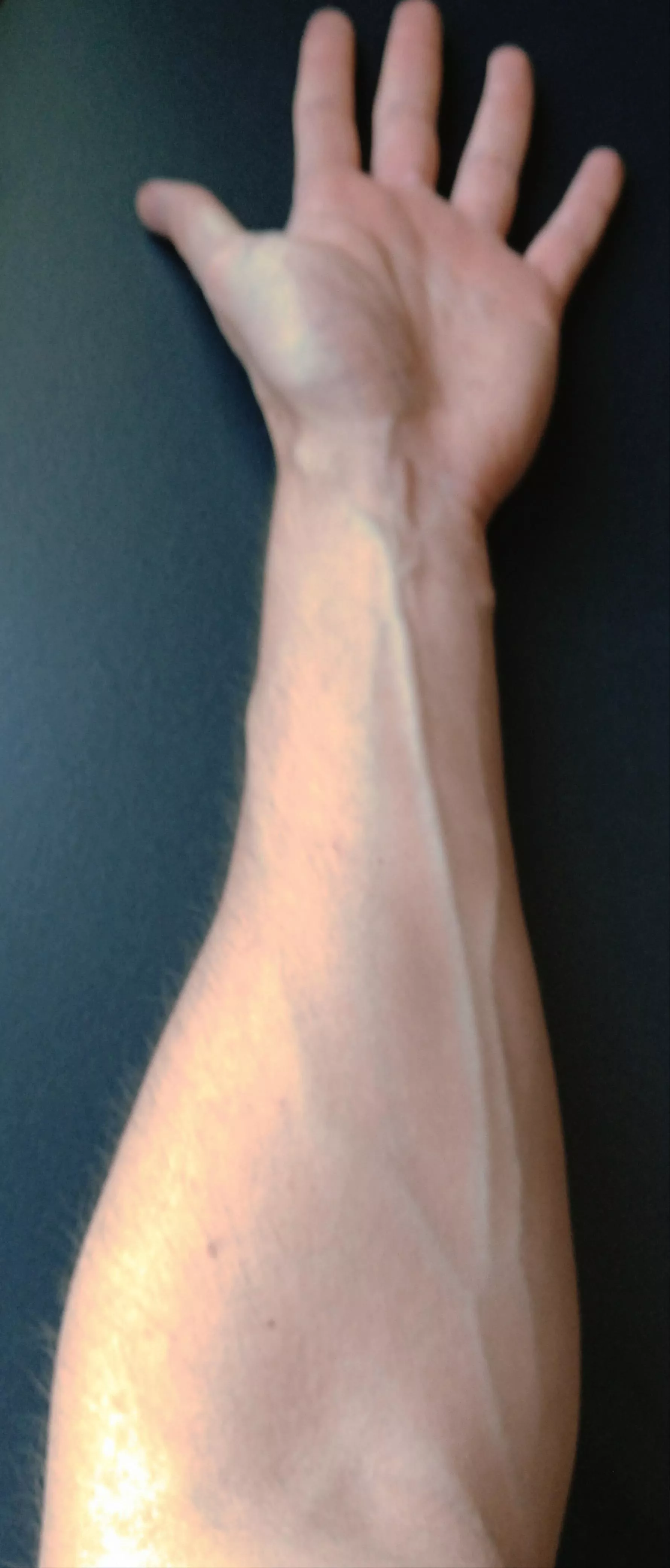 Any love for veins? posted by Handsjoyer