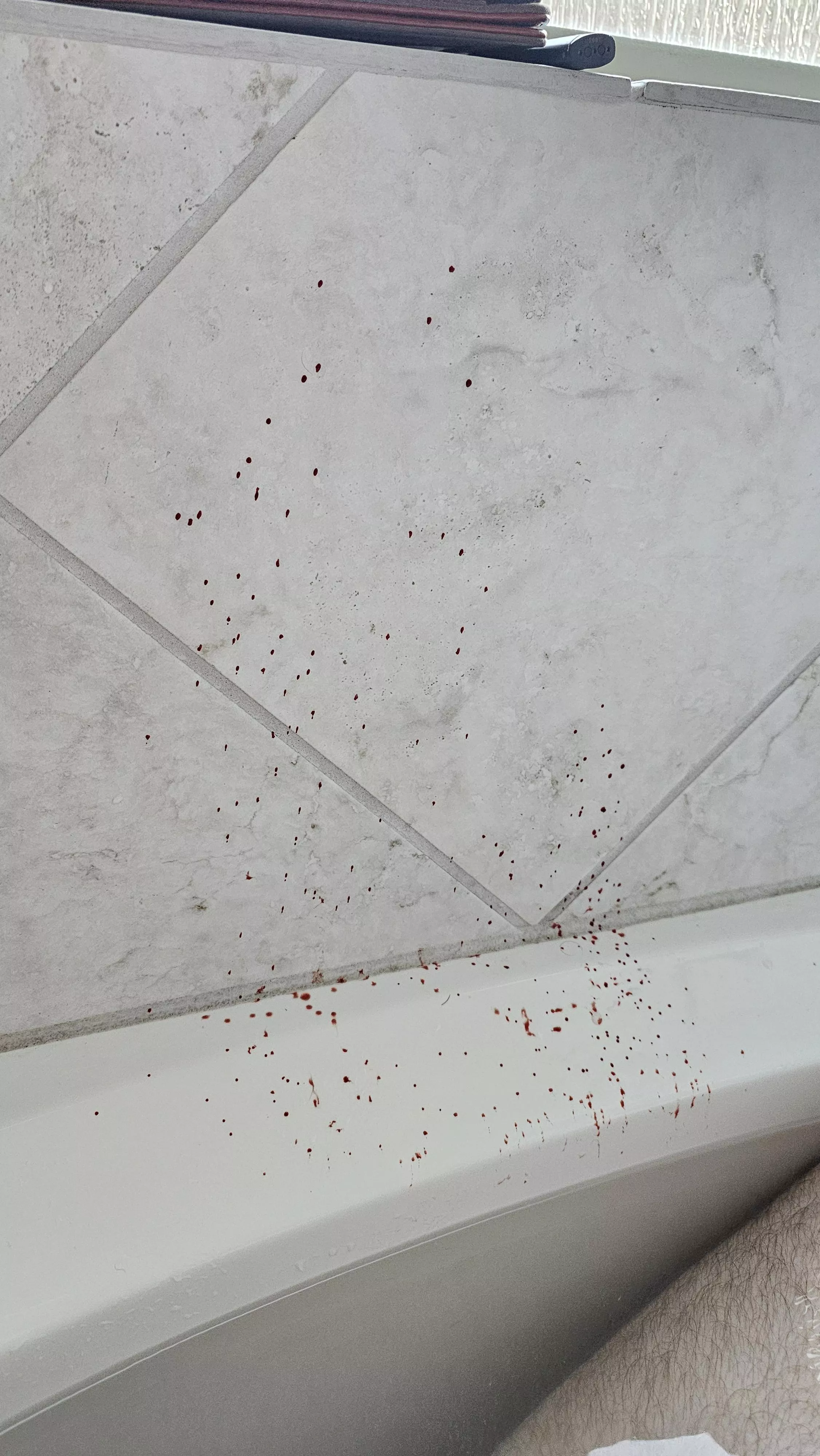 Bathtub boil mishap(blood) posted by Gibmiester
