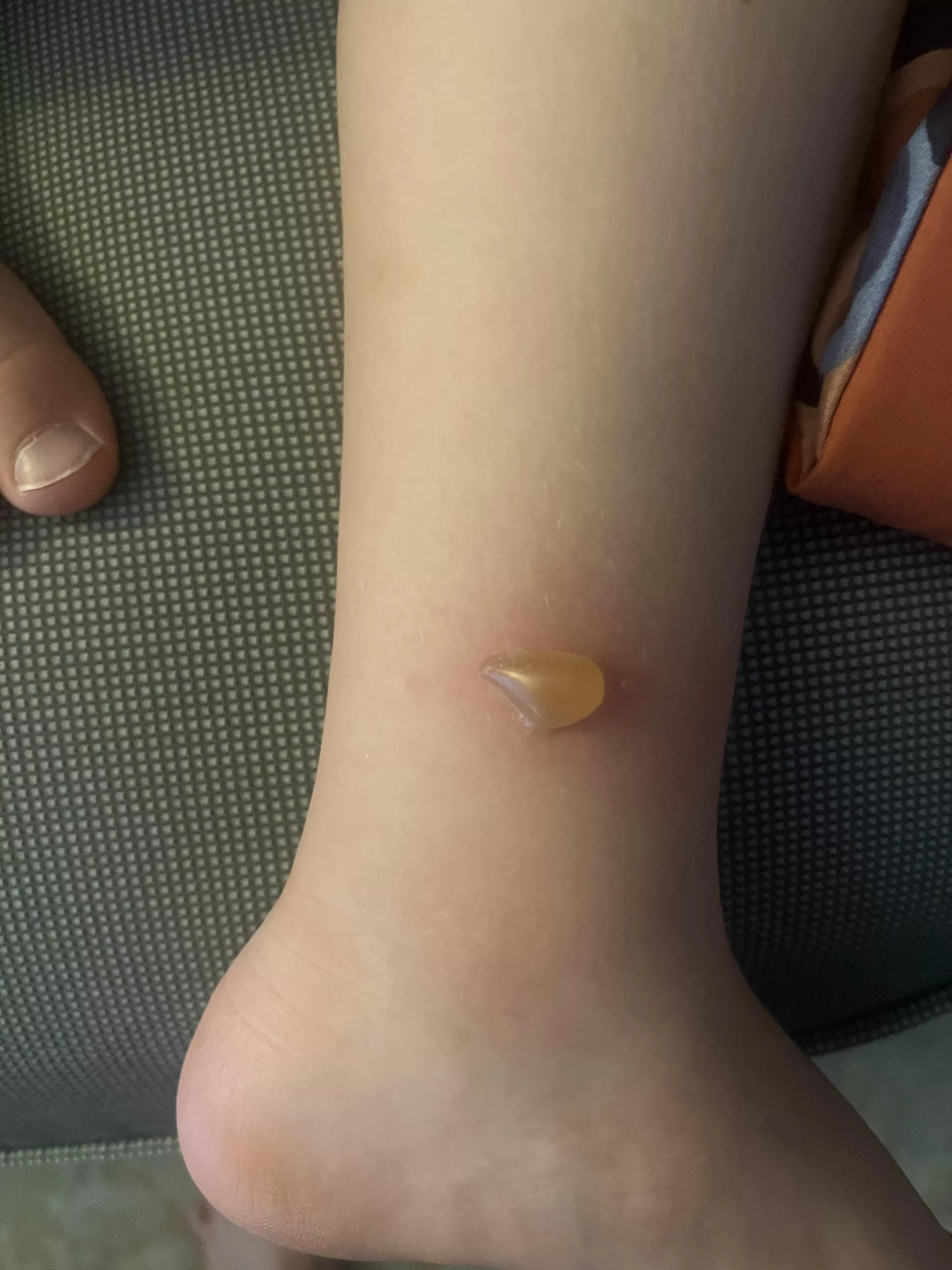Forbidden Pop From Invasive Mosquitoes posted by shainadawn