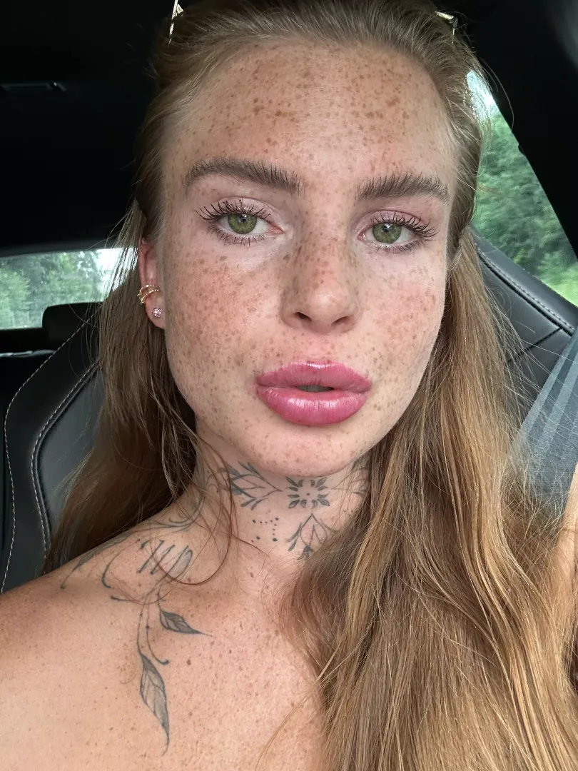 Yes I'm covered in freckles.. by AnyAdsz