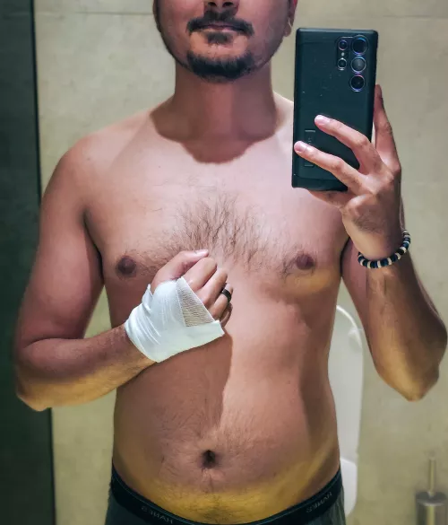 A speeding cyclist rode straight into me and knocked me out. Would you tend to my wounds, and my needs? by LeafyGreenWild