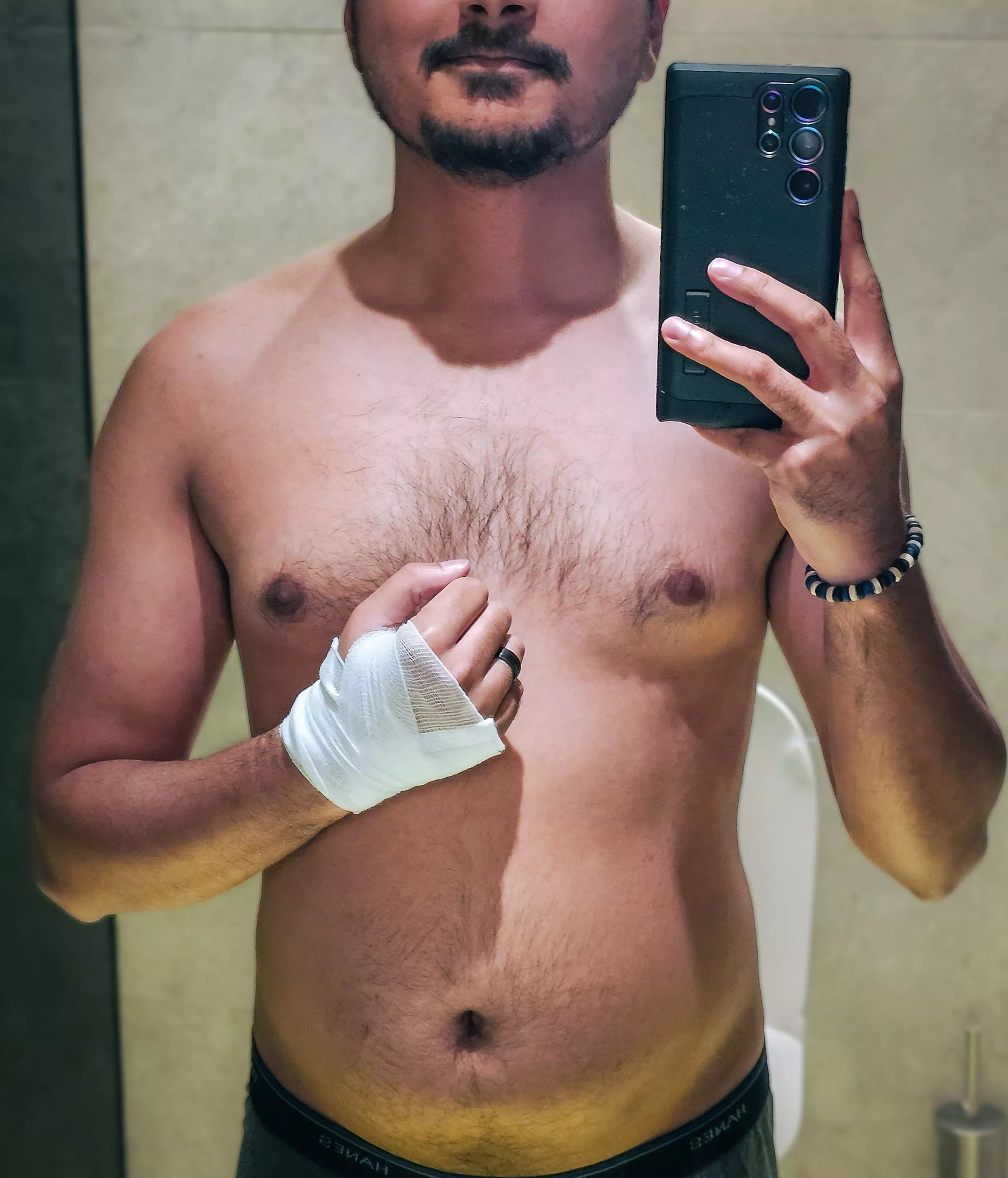 A speeding cyclist rode straight into me and knocked me out. Would you tend to my wounds, and my needs? posted by LeafyGreenWild