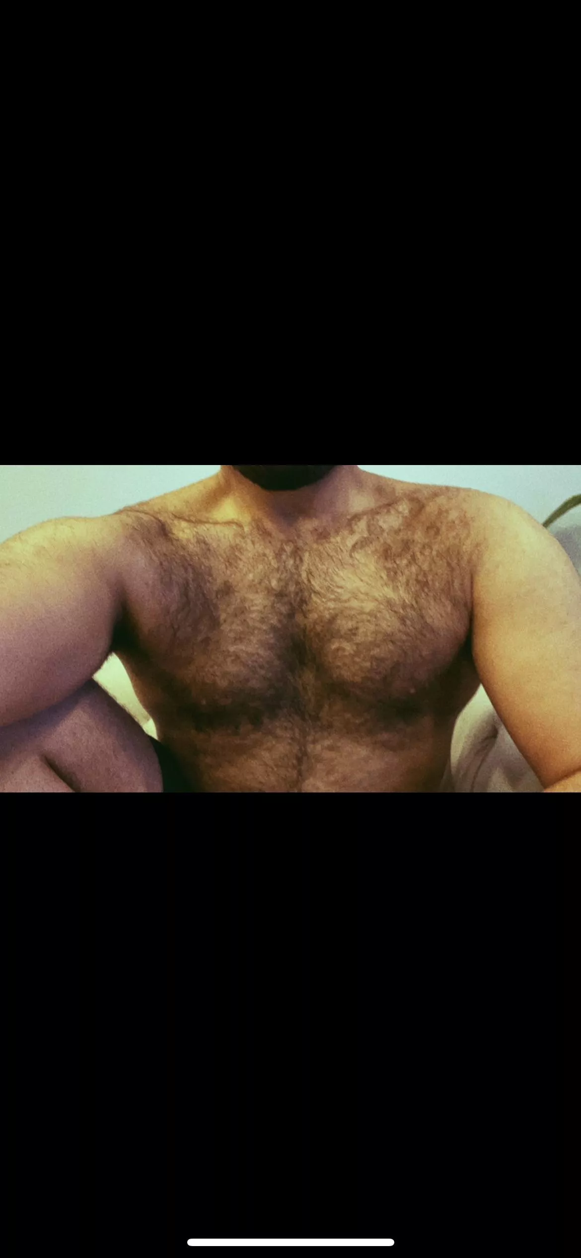 Hairy chesticals posted by One_Ant_6788