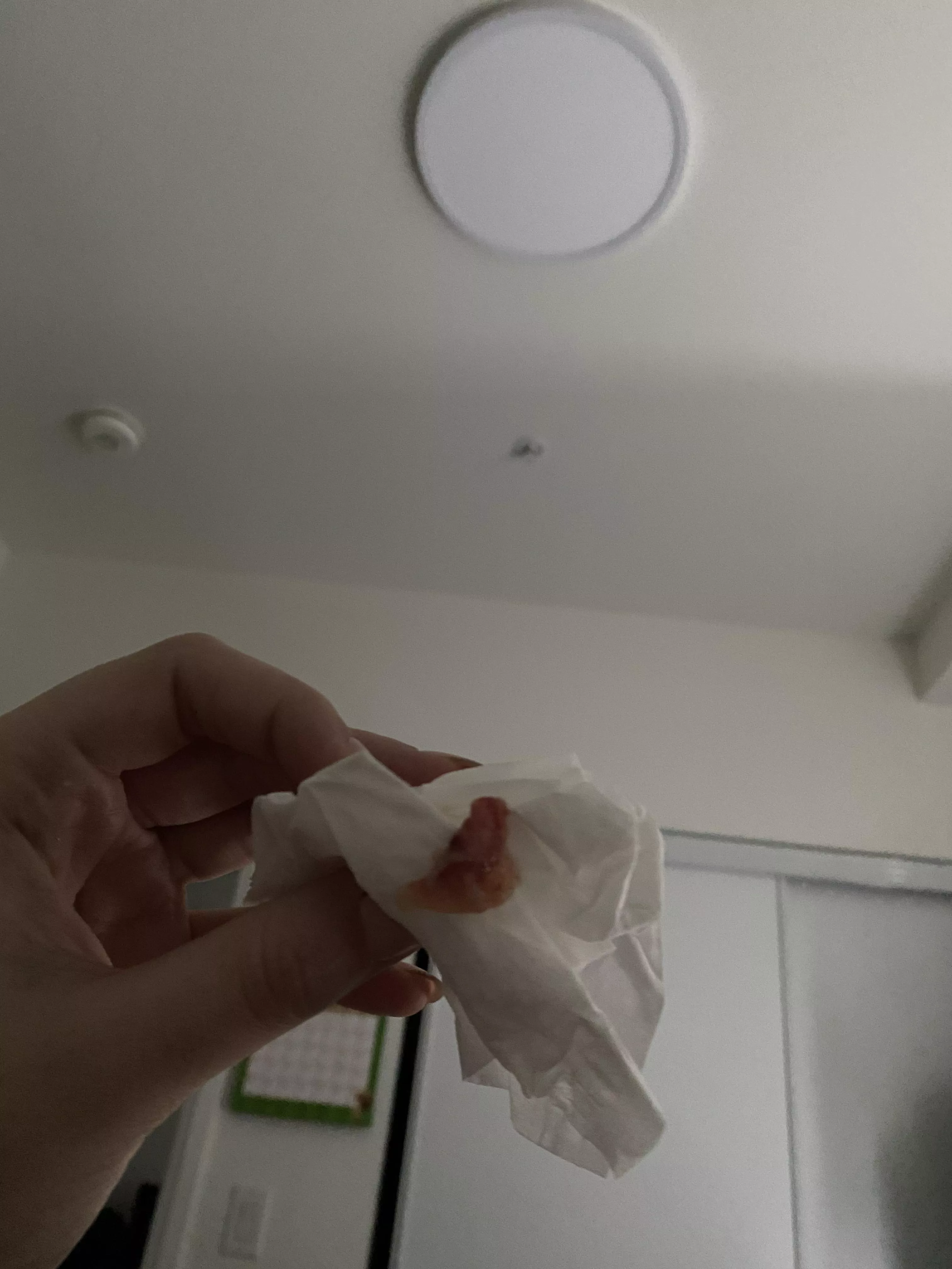 Blew this out of my nose today. Pretty sure I have Covid. posted by crimsonlights