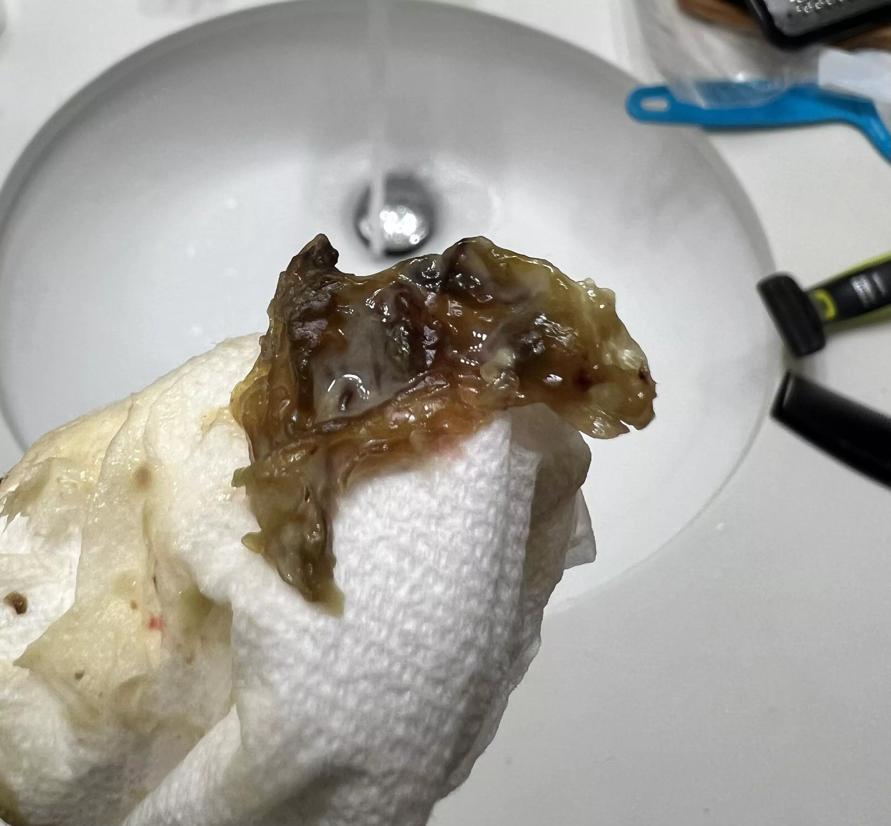 Endoscopic Sinus Surgery posted by MrRagerTV